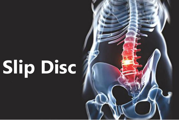 Rectitude Wellness Physiotherapy