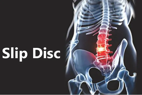 Rectitude Wellness Physiotherapy