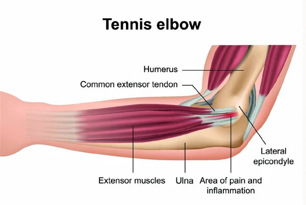 Rectitude Wellness Physiotherapy