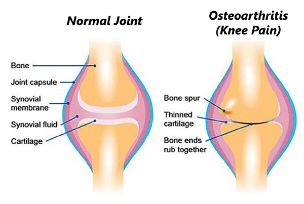 Rectitude Wellness Physiotherapy