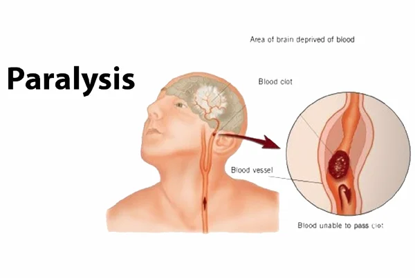 Rectitude Wellness Physiotherapy