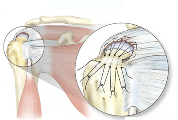 Rectitude Wellness Physiotherapy