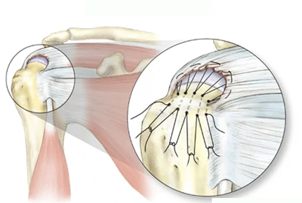 Rectitude Wellness Physiotherapy