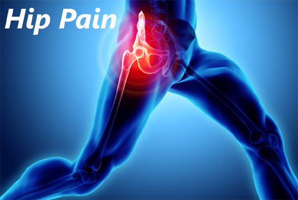 Hip Pain