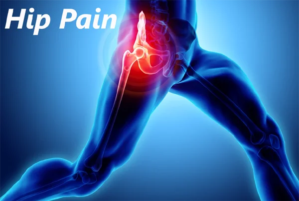 Hip Pain
